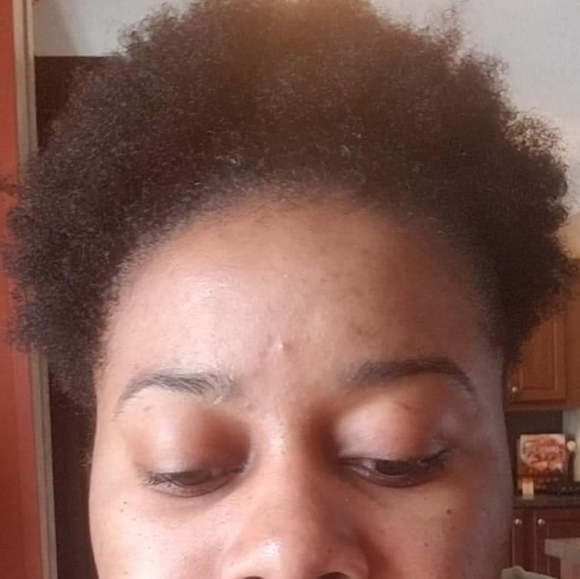 Turmeric and Honey Acne Face Soap - Picture 5 of 5